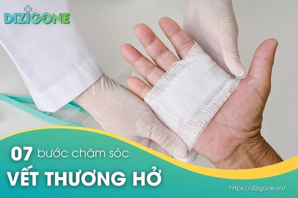 cham-soc-vet-thuong-ho chăm sóc vết thương hở