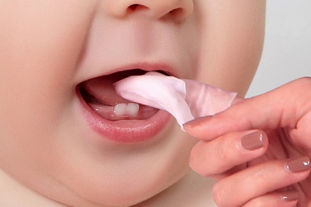 Ảnh 2 - 7 Mẹo chữa nấm miệng ở trẻ em tại nhà
