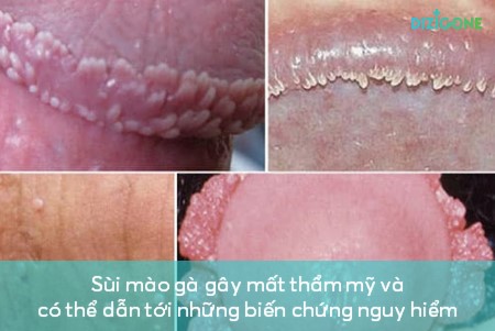 dung-dich-ve-sinh-nam dung dịch vệ sinh nam 2
