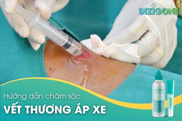 cham-soc-vet-thuong-ap-xe chăm sóc vết thương áp xe