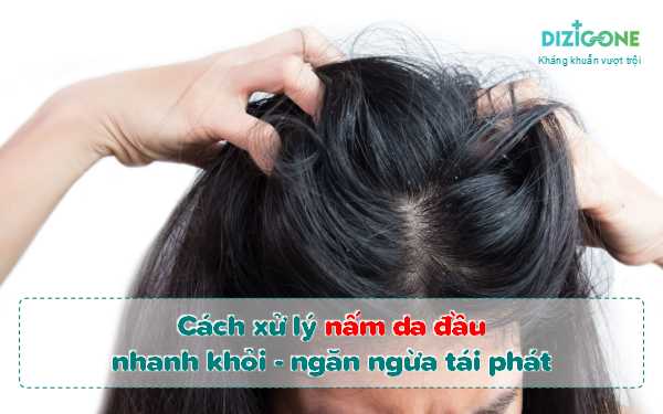 7 cách trị da đầu nhờn (đổ dầu) tại nhà và 6 nguyên nhân phổ biến