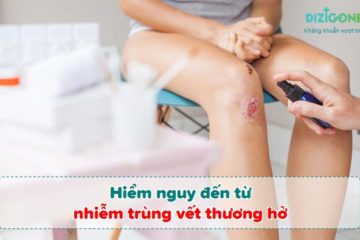 nhiem-trung-vet-thuong-ho nhiễm trùng vết thương hở