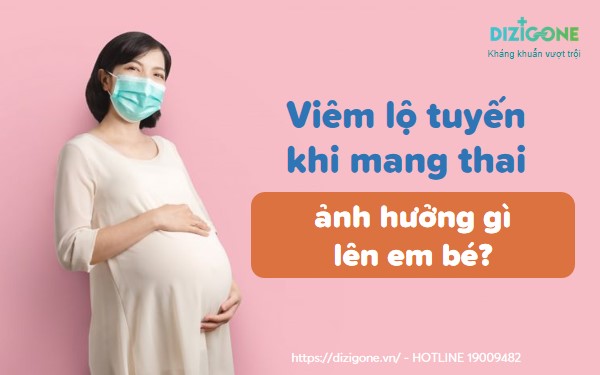 viem-lo-tuyen-khi-mang-thai viêm lộ tuyến khi mang thai