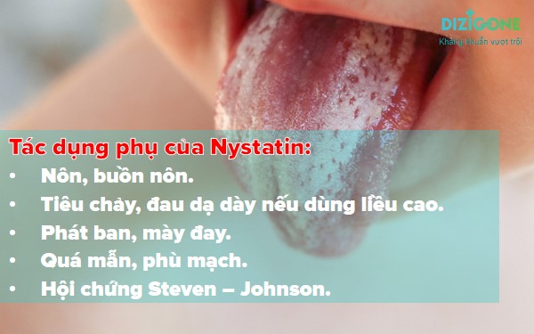 thuoc-nam-mieng-nystatinthuốc nấm miệng Nystatin 