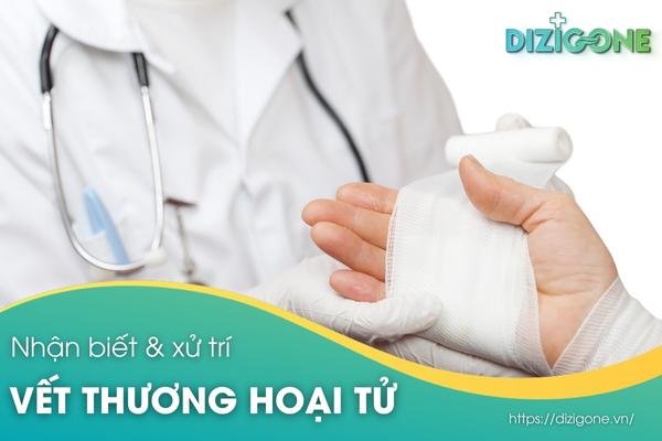 Có những biện pháp phòng ngừa nào để tránh hoại tử ngón chân? 
