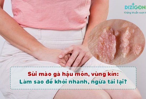 Sùi mào gà hậu môn, vùng kín: làm sao để khỏi nhanh, ngừa tái lại? Sùi mào gà hậu môn, vùng kín: làm sao để khỏi nhanh, ngừa tái lại?