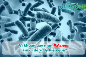 Vi khuẩn gây mụn P.Acnes
