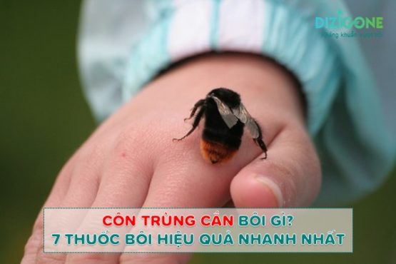 thuoc-boi-con-trung-can-cho-tre-em thuốc bôi côn trùng cắn cho trẻ em