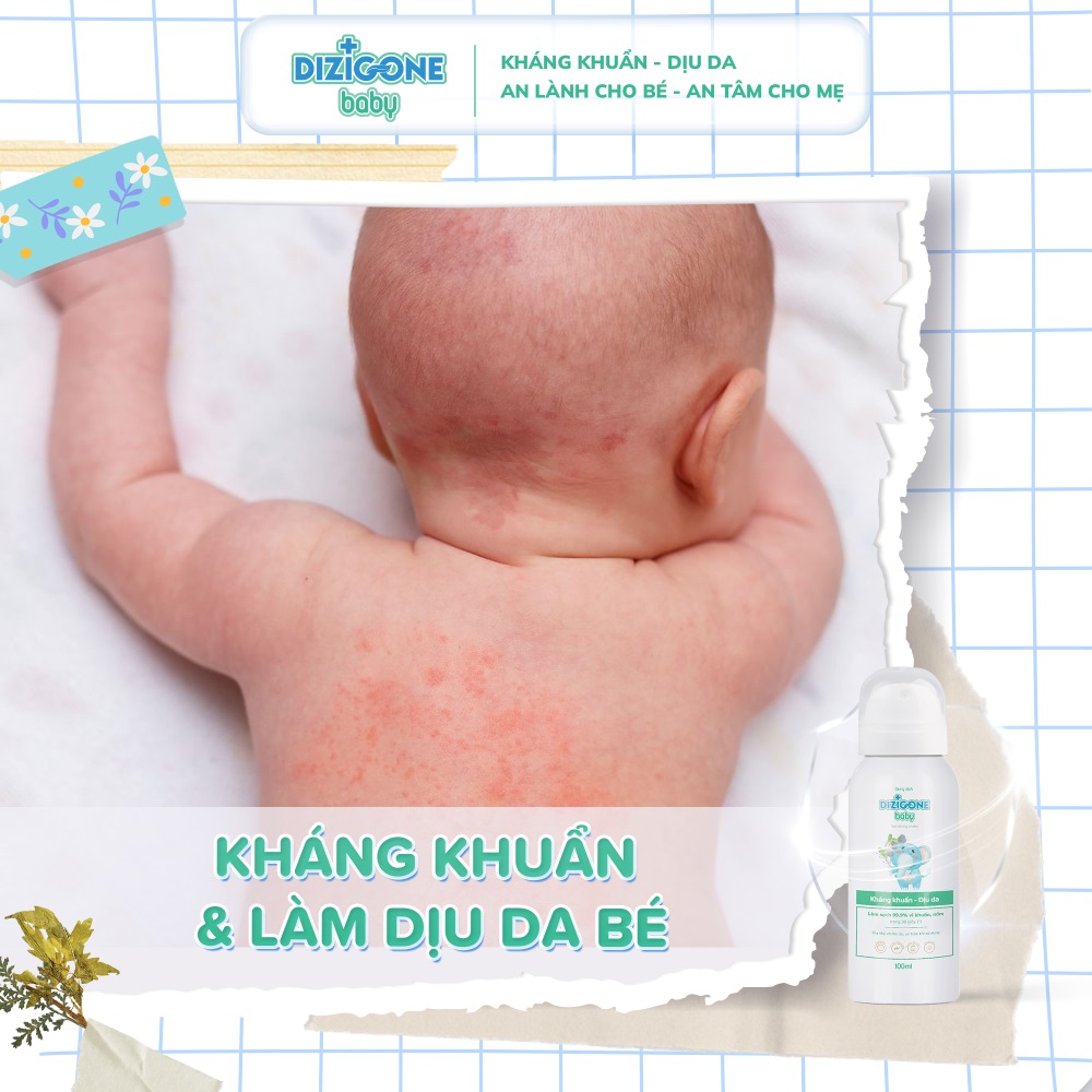 xịt kháng khuẩn dizigone baby 100ml 