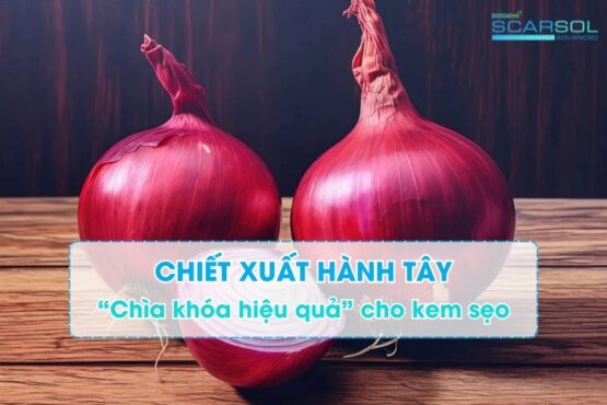 Chiết xuất hành tây – “Chìa khóa hiệu quả” trong kem bôi trị sẹo thông dụng